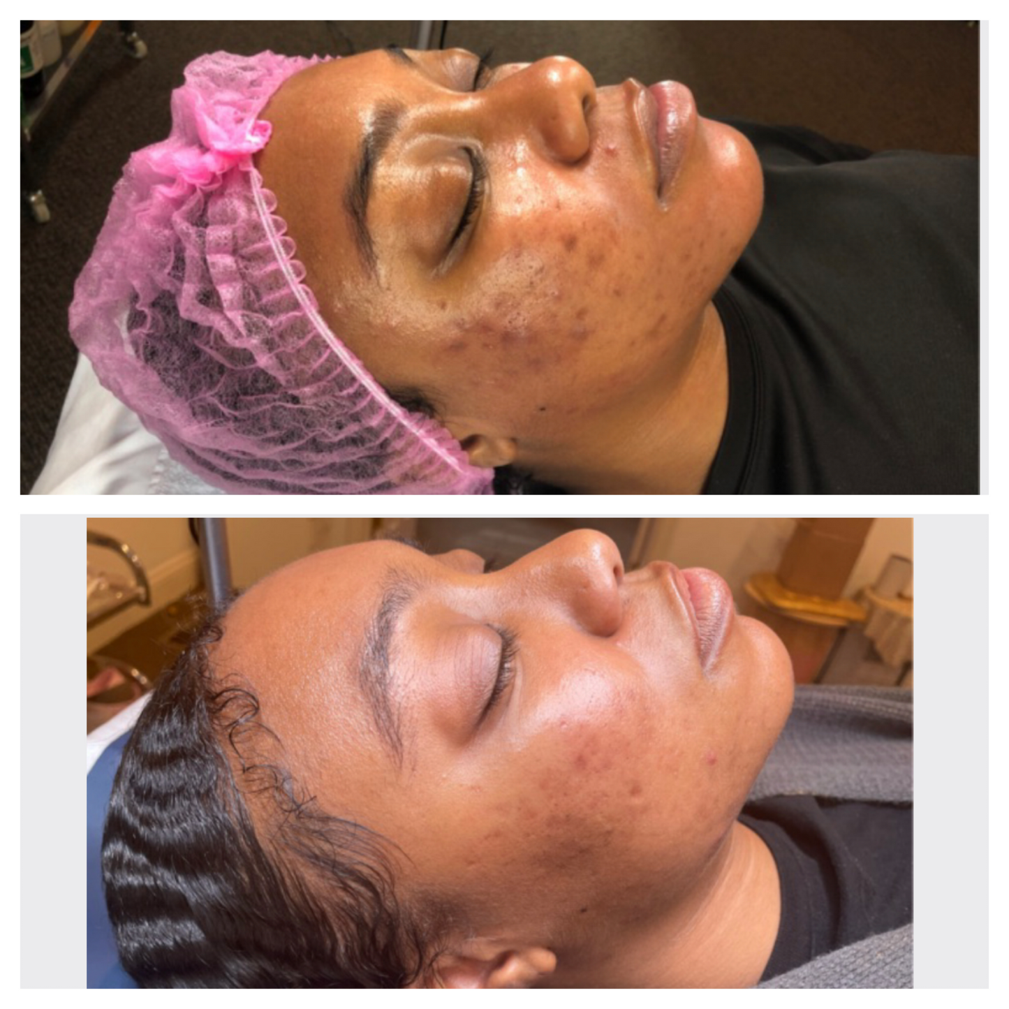 Brightening Pads